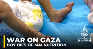 War on Gaza: Boy dies of malnutrition, doctors sound alarm