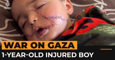 Injured Gaza 1-year-old suffers 200 facial stitches and hand amputation | Al Jazeera Newsfeed