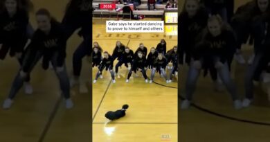Teen With No Limbs Performed Incredible Dance Routine #shorts
