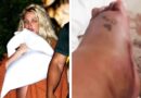 Britney Spears Shows Off Bruised Foot After Hotel Incident