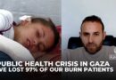 97% of Burn victims died in Gaza as hospitals collapsed under siege, doctor reveals