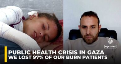 97% of Burn victims died in Gaza as hospitals collapsed under siege, doctor reveals