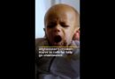 Afghanistan’s children starve as calls for help go unanswered | AJ #shorts