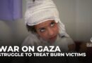 Gaza’s burn patients suffer as Israel’s blockade chokes crucial medical supplies