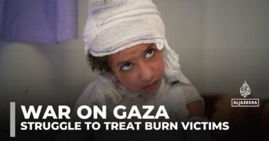 Gaza’s burn patients suffer as Israel’s blockade chokes crucial medical supplies