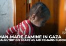Hunger deepens in Gaza amid Israeli blockade: Malnutrition soars as aid remains blocked