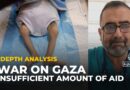 Israel’s aid blockade is causing generational damage: Gaza doctor
