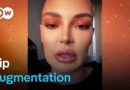 The new face – The hyaluron beauty hype | DW Documentary