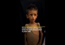Gaza mother pleads for help to save emaciated 5-year-old | AJ #shorts