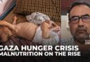 Babies in Gaza face irreversible harm from starvation and lack of aid, doctors warn