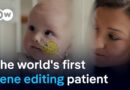 Baby receives world’s first personalized gene-editing treatment | DW News