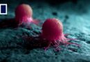 China-Singapore team’s nanovaccine suppresses cancer recurrence and spread in animal tests