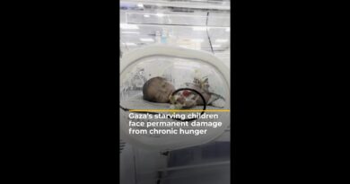 Gaza’s starving children face permanent damage from chronic hunger