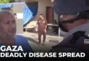 Infectious diseases spreading due to lack of clean water, food: Gaza doctor