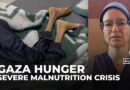 ‘Many Palestinians in Gaza are just skin and bone’: Doctor