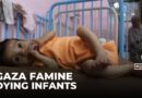Mass starvation taking hold in Gaza: Malnourished children overwhelming hospitals