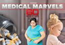 Medical marvels: Remarkable breakthroughs, discoveries and stories | 60 Minutes Anthology