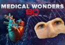 Medical wonders: Groundbreaking discoveries and treatments | 60 Minutes Anthology