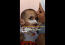 Paralysed 3-year-old’s suffering worsens after Israeli attack in Gaza | Al Jazeera NewsFeed