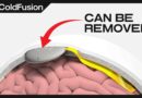 The Race to Control Our Brains Is Heating Up