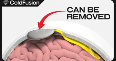The Race to Control Our Brains Is Heating Up