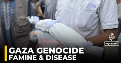 Famine in Gaza is not just food — it’s water, disease, and despair: Physician from Gaza
