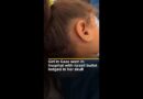 Gaza child in hospital with Israeli bullet protruding from her skull | AJ #shorts