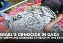 Gaza health crisis: Autoimmune diseases spread amid Israeli siege and shortages