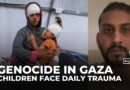 Gaza’s children face war, starvation, and daily massacres: Paediatrician