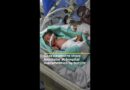 Newborns share incubator at Gaza hospital overwhelmed by famine | AJ #shorts