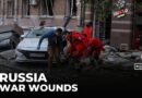 Russian war veterans face amputations and trauma after frontline battles