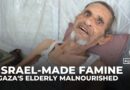 ‘Skin and bone’: Israeli-made starvation crisis taking a toll on Gaza’s elderly