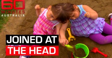 The conjoined twins who see, smell and think the same things | 60 Minutes Australia