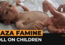 This is the human tragedy caused by Israel’s famine in Gaza | Al Jazeera Newsfeed