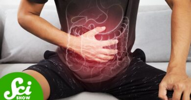 Why More Young People Are Getting Colon Cancer