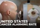 Alarming rise in late-stage cancer diagnoses among Americans under 50