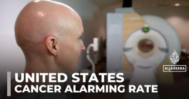 Alarming rise in late-stage cancer diagnoses among Americans under 50