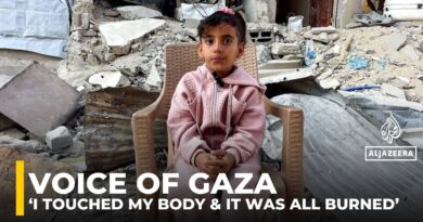 Gaza girl orphaned in Israeli strike rebuilds her life with severe burns