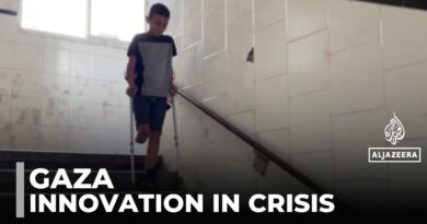 Physical scars of war: health ministry reports 6,000 amputations