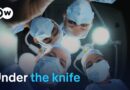 Amputation without anesthetic – The painful history of surgery | DW Documentary