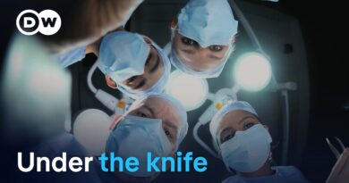 Amputation without anesthetic – The painful history of surgery | DW Documentary