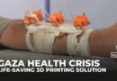 Gaza doctors use solar‑powered 3D printing to save limbs and lives