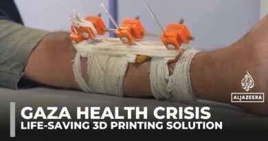 Gaza doctors use solar‑powered 3D printing to save limbs and lives