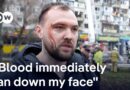 Kyiv residents tell DW how they survived Russian a missile strike on their home | DW News