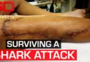 What saved a woman’s life when a shark attacked in shallow waters | 60 Minutes Australia