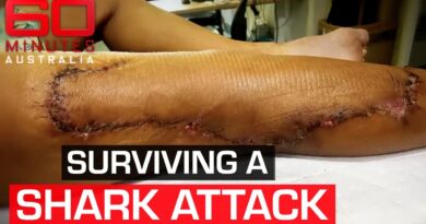 What saved a woman’s life when a shark attacked in shallow waters | 60 Minutes Australia