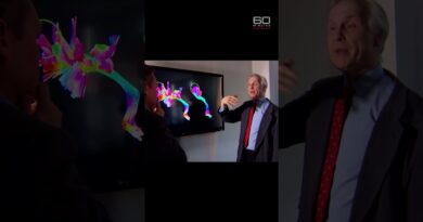 What autism looks like inside the brain | 60 Minutes Australia