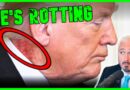 Trump Literally Rotting To Death In Front Of Us | The Kyle Kulinski Show
