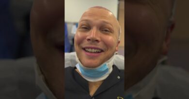 Here’s what getting new #hair in #Turkey is really like. #hairtransplant