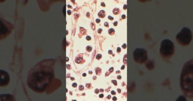 How Dangerous Is Hantavirus?